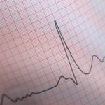 malattie cardiovascolari